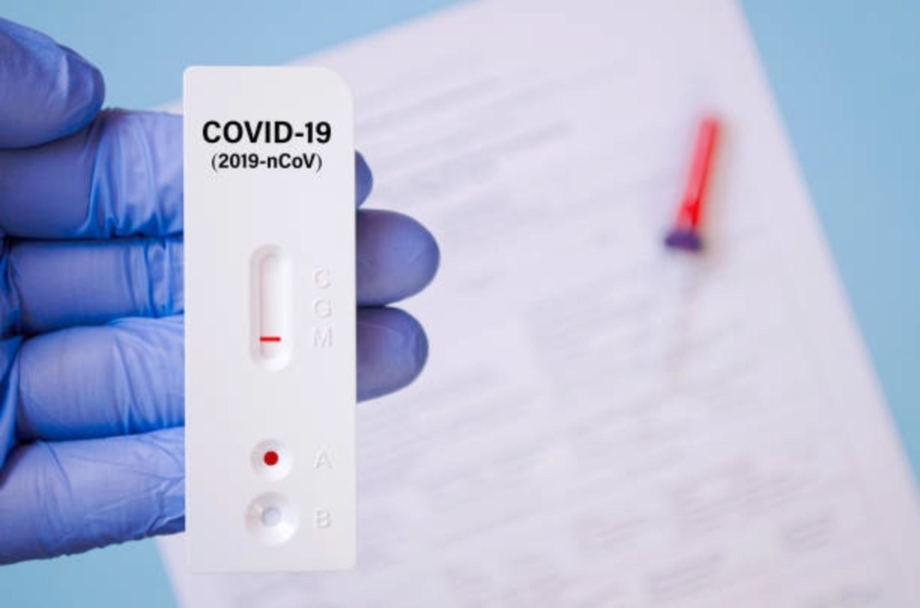 222 новых случая заболевания COVID-19 выявлено в Поморье