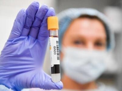 546 новых случаев коронавируса выявлено в области за сутки 