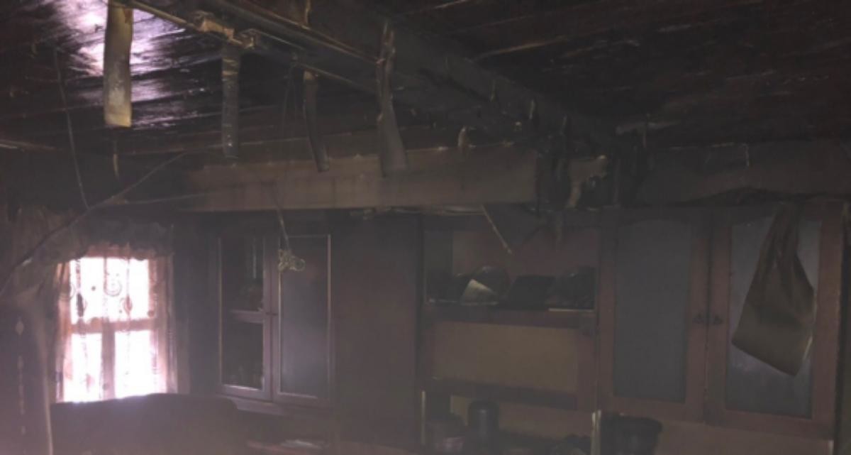 Тушение пожара для жителя Коряжмы закончилось реанимацией