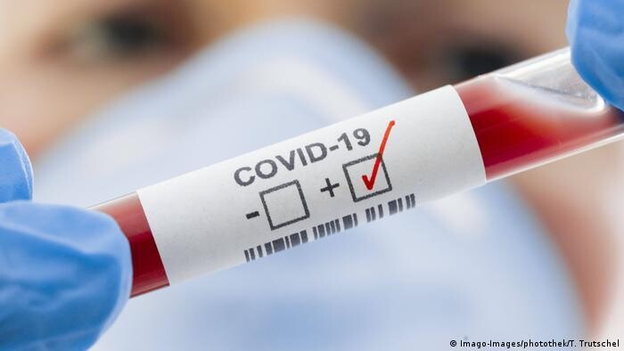 Оперштаб: за последние сутки в Поморье выявлено 160 новых случая заболевания COVID-19