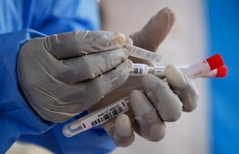 За последние сутки в области выявлено 127 случаев коронавируса